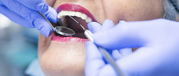Best Broken or Chipped Tooth Repair in Brentwood, MD